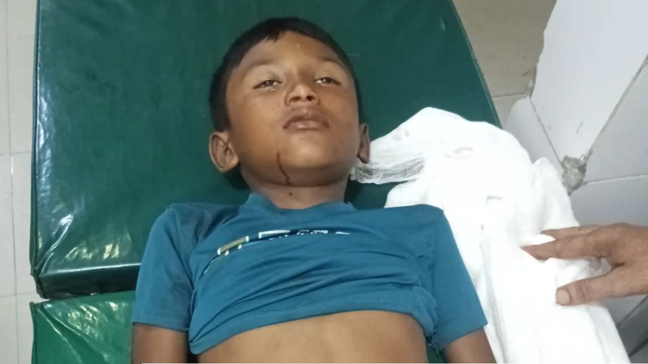 সুনামগঞ্জের গৌরারংয়ে অটোরিকশার ধাক্কায় এক স্কুল শিক্ষার্থীর মৃত্যু